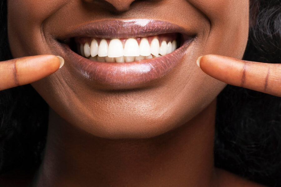 smiling woman demonstrating the results of teeth whitening