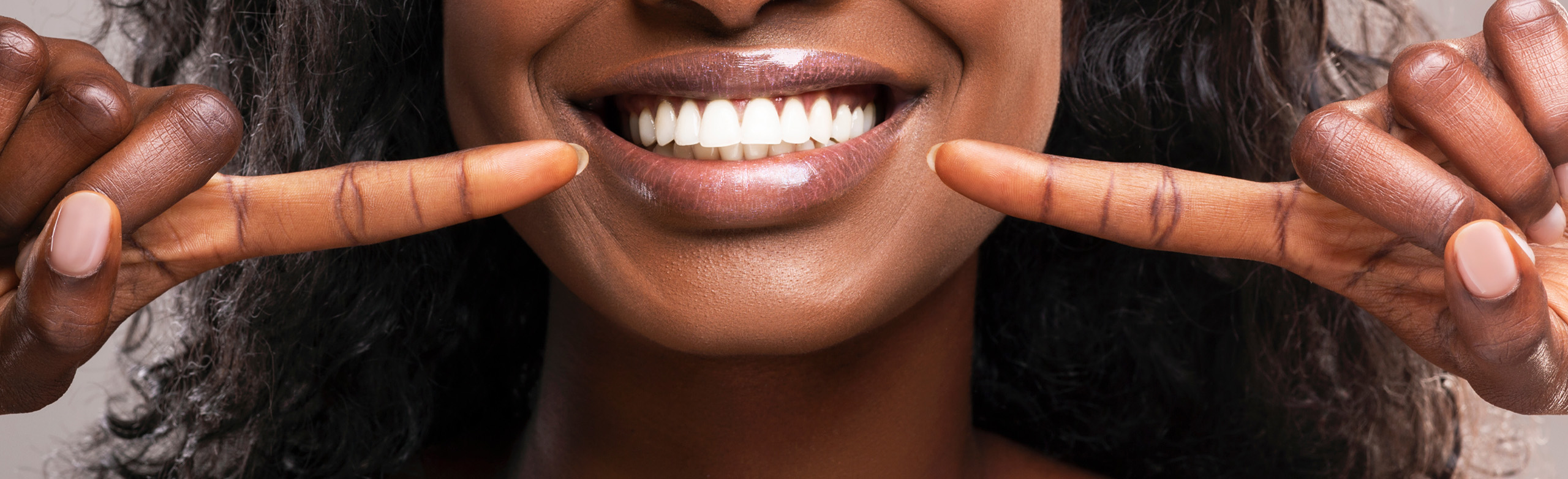Can you whiten your teeth during orthodontic treatment